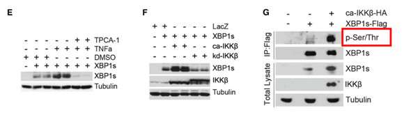 IKKβ 磷酸化 X-Box 结合蛋白 1
