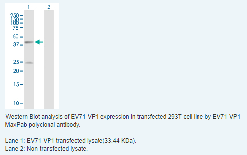 EV71-VP1抗体