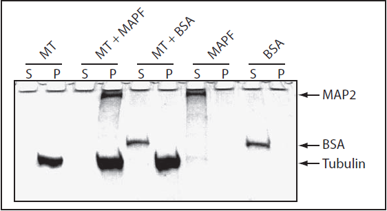 微管结合蛋白分析试剂盒.png