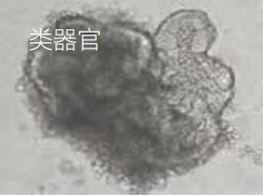 类器官