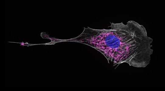 超高分辨显微镜(Super-resolution Microscopy)成像