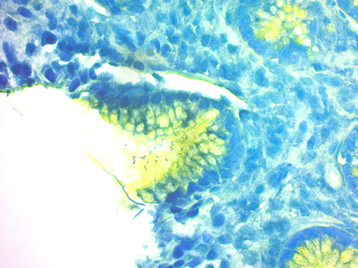 Helicobacter-pylori-1.png