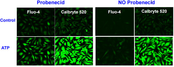 加或者不加丙磺舒（probenecid）对Fluo-4和Calbryte 520荧光标记结果的影响.jpg