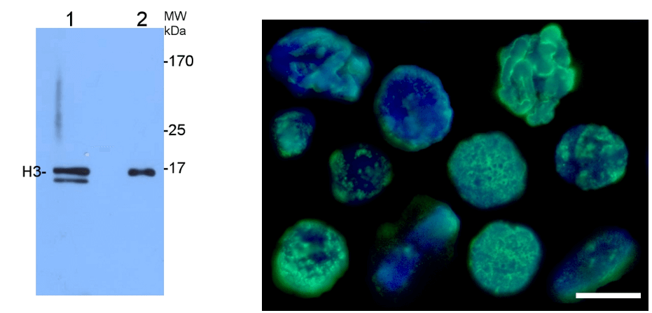 组蛋白H3抗体应用实例.png