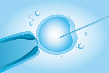 体外受精(In Vitro Fertilization).png