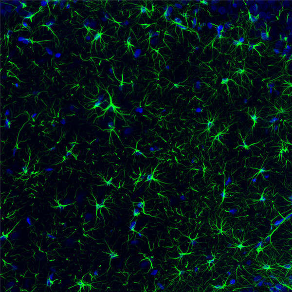 GFAP / glial fibrillary acidic protein.jpg