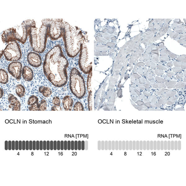 Occludin / OCLN.jpg