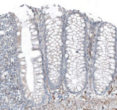 SALL4 / spalt-like transcription factor 4.jpg