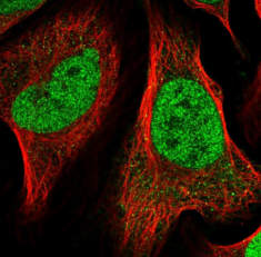 NACC1 / nucleus accumbens associated 1.jpg