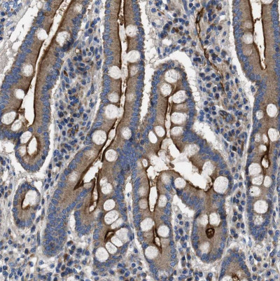 使用CD73抗体 （HPA017357）检测人十二指肠，IHC显示腺细胞顶端膜呈强阳性.jpg