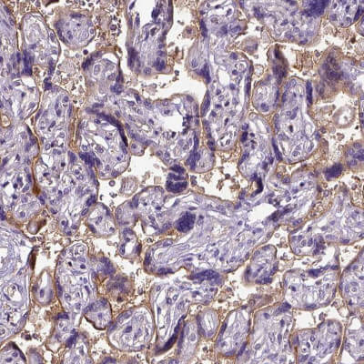使用CD105抗体（HPA011862）人胎盘，IHC显示滋养层细胞中度膜阳性.jpg