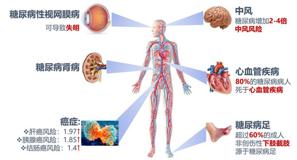 糖尿病相关并发症.jpg