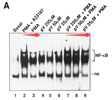 转录因子NF-κB调节参与免疫和炎症反应的基因