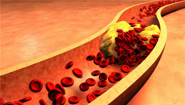 肝素诱导的血小板减少症