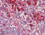 SPA-827_IHC.jpg