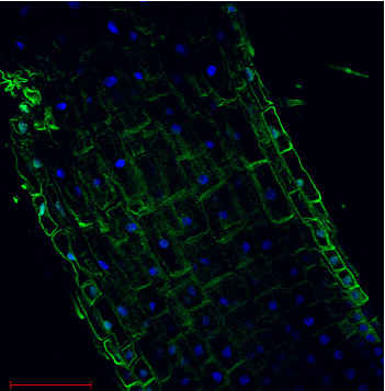 Immunolocalization.png