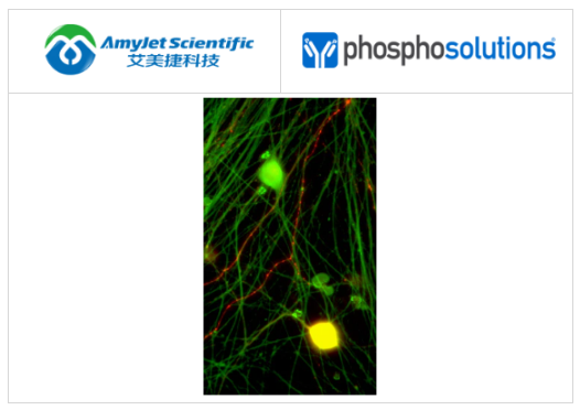 抗降钙素基因相关肽 （CGRP） 抗体