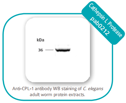 Chromatin IP 染色质免疫沉淀 