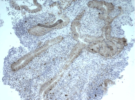 ENZ-ABS677PB-0100.png