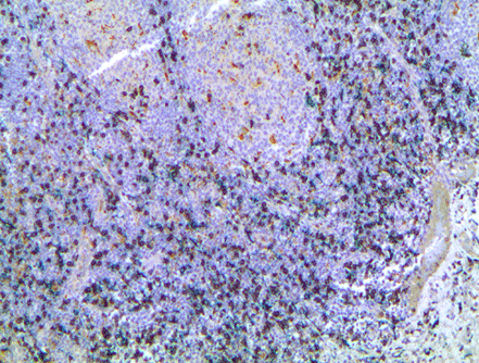 HIGHDEF 黑色 IHC 显色原 （HRP）
