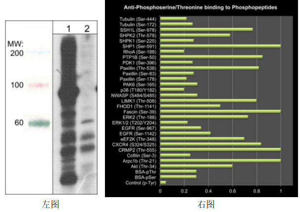 Anti-Phosphoserine/threonine（通用磷酸化抗体-抗磷酸化丝氨酸/苏氨酸）