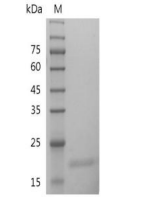 重组人IL-28A的SDS-PAGE分析