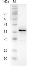 重组人CHI3L1的SDS-PAGE分析