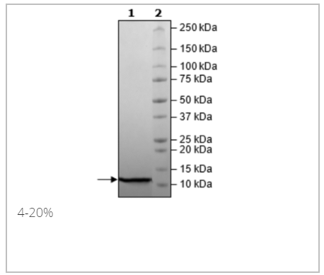 Ubiquitin, His-Tag重组蛋白