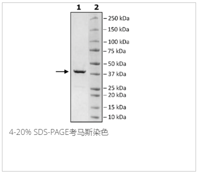 HSP40, His-tag重组蛋白