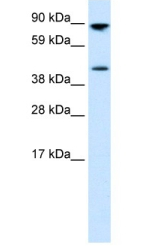 Aviva Systems Biology