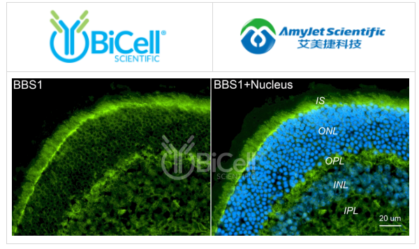 BBS1抗体（N末端）染色