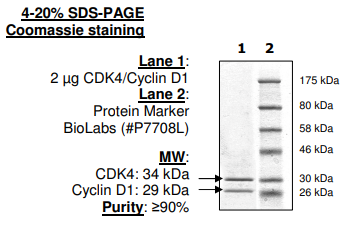 CDK4(EE,T172A)/Cyclin D1, His-tag 重组蛋白