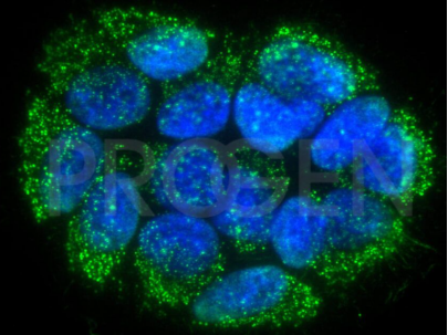 抗DNA,AC-30-10,小鼠单抗/anti-DNA, AC-30-10, mouse mab