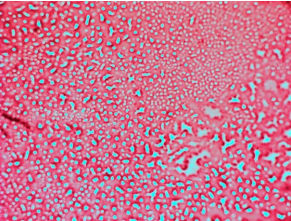 Red 549 Mab
