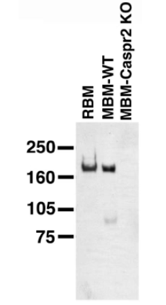 来自野生型（WT）和Caspr2敲除小鼠的成年大鼠脑膜（RBM）和成年小鼠脑膜（MBM）上的免疫印迹