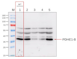 抗PDHE 1-B|丙酮酸脱氢酶E1组分亚基β-1,线粒体