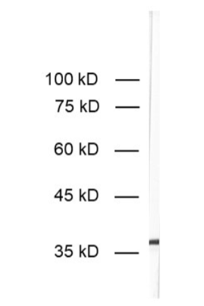 HS-477 017BT.png