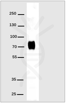 DIMA BIOTECH