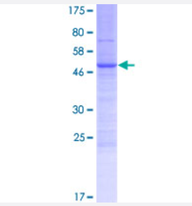 Western Blot（转染裂解液）