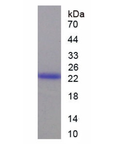 abx067611.png