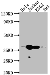 Epigentek-CDK6重组单克隆抗体[8G3]：