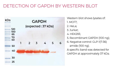 KIT-GAPDH-100-3.png