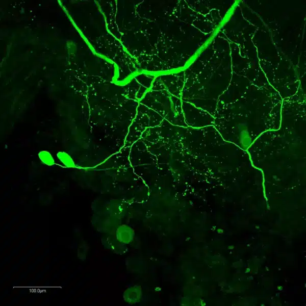 StainPerfect? Immunostaining Kit A.png
