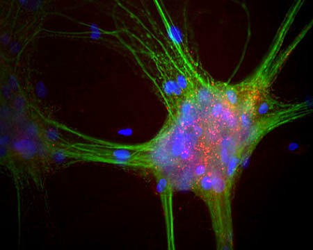 Alpha-Synuclein.png