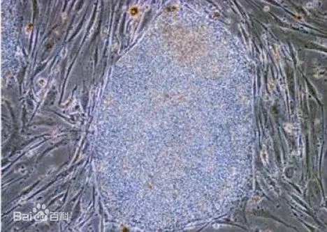 T-lymphocyte.jpg