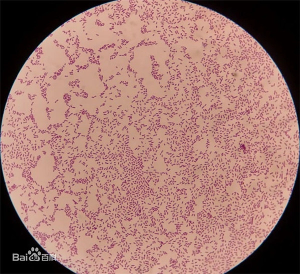 Pseudomonas aeruginosa.jpg
