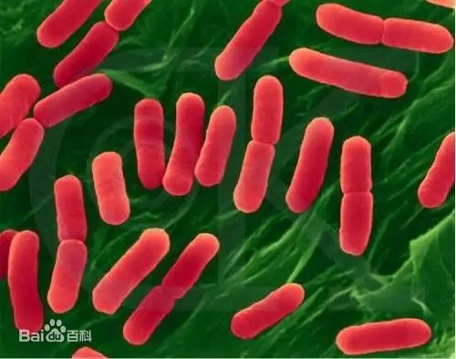 Escherichia coli.jpg