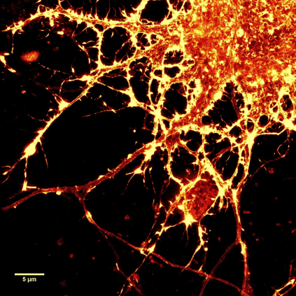 SiR-Actin染色的神经元.png