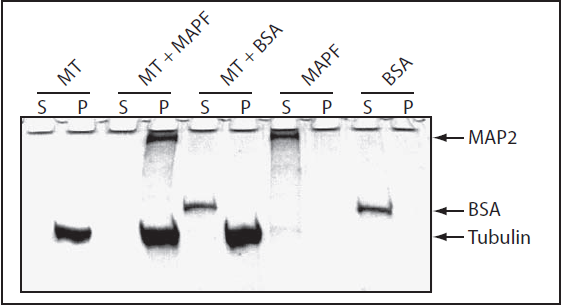 微管结合蛋白分析试剂盒