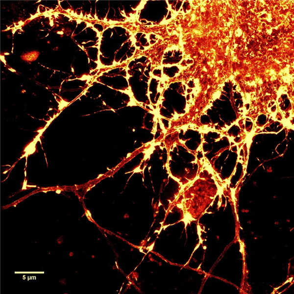 SiR-Actin染色的神经元